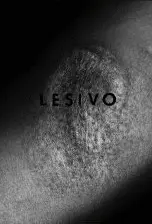 LESIVO
